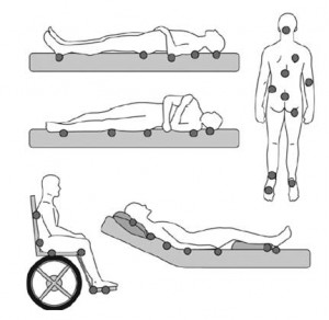 escaras